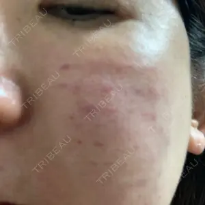 HAAB×DREAM BEAUTY CLINIC 大阪梅田院口コミ