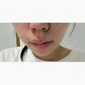 PRO CLINIC プロクリニック 銀座院口コミ