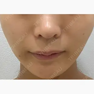 ASTRA BEAUTY CLINIC口コミ