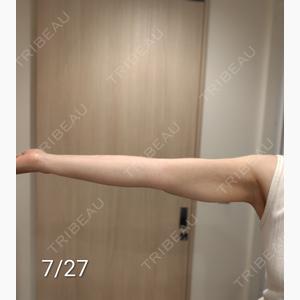 脂肪吸引の森クリニック東京院口コミ