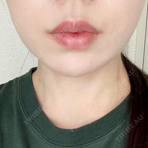 TCB東京中央美容外科 秋田院口コミ