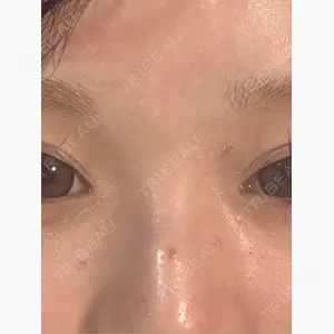 心斎橋KT美容クリニック口コミ