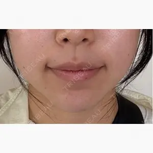 HAAB×DREAM BEAUTY CLINIC 大阪梅田院口コミ