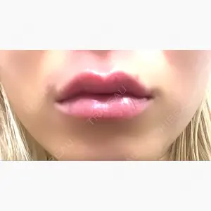 ルラ美容クリニック 名古屋本院口コミ