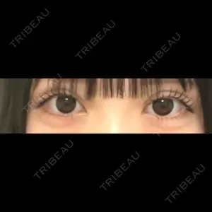 アリエル美容クリニック 大宮院口コミ
