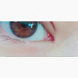 ジュエリー美容外科口コミ
