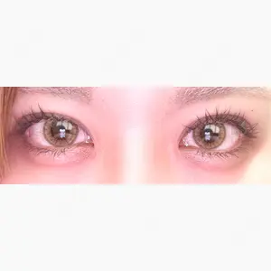 アリエル美容クリニック 大宮院口コミ