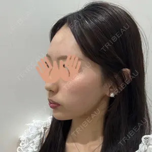 HAAB×DREAM BEAUTY CLINIC 大阪梅田院口コミ