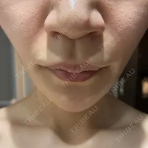 DAILY SKIN CLINIC 新宿院口コミ