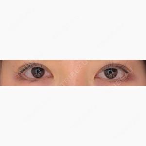 HAAB×DREAM BEAUTY CLINIC 大阪梅田院口コミ