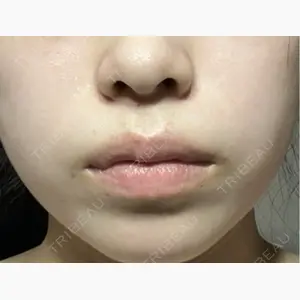 TCB東京中央美容外科 宇都宮院口コミ