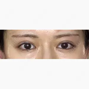 東京シンデレラ美容外科 池袋院口コミ