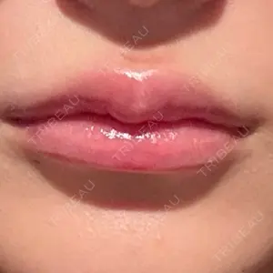 AI Beauty Clinic （エーアイ美容クリニック）口コミ