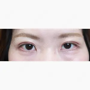 アリエル美容クリニック 大宮院口コミ