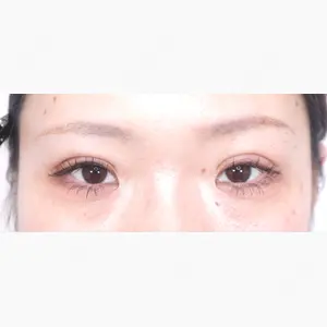 アリエル美容クリニック 水戸院口コミ