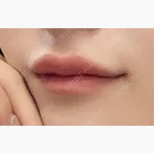 PRO CLINIC プロクリニック 銀座院口コミ
