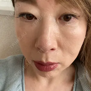 藤・ナチュレ美容クリニック 銀座院口コミ