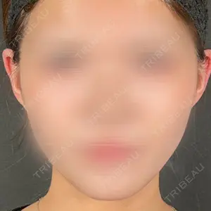 R Beauty CLINIC 名古屋院口コミ