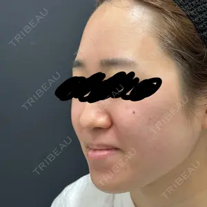 ルラ美容クリニック 広島院口コミ