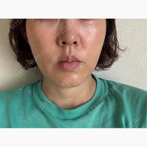 LUNAGE CLINIC（ルナージュクリニック）口コミ