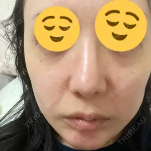 ルラ美容クリニック 郡山院口コミ