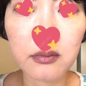グナル美容外科梅田院口コミ