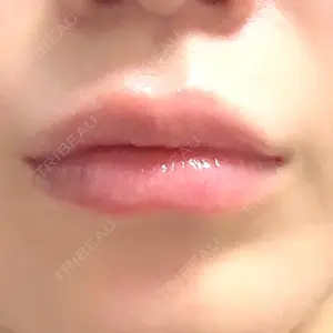 名古屋駅前ゆう美容クリニック口コミ