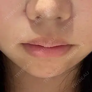 ルラ美容クリニック 大阪本院口コミ