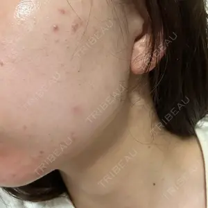 ルラ美容クリニック 大宮院 / ルラスキンクリニック 大宮院口コミ