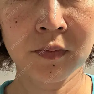 聖心美容クリニック 横浜院口コミ