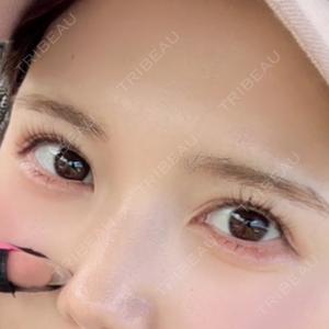 湘南美容クリニック 札幌院口コミ