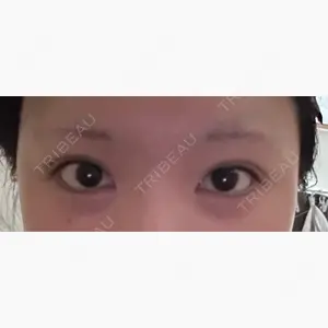 HAAB×DREAM BEAUTY CLINIC 東京本院口コミ