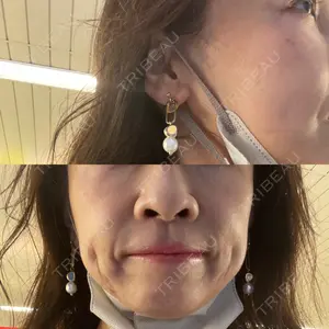 HAAB×DREAM BEAUTY CLINIC 大阪梅田院口コミ