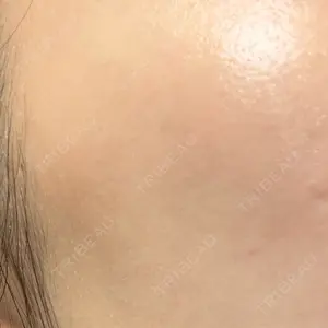 ゼノクリニック口コミ