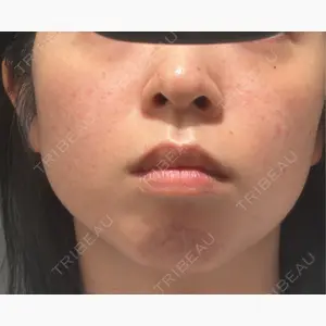 HAAB×DREAM BEAUTY CLINIC 東京本院口コミ
