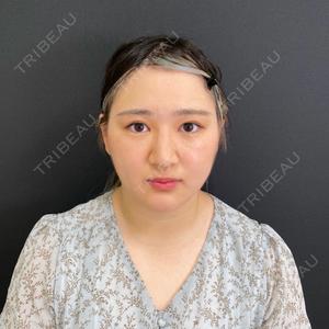自由が丘ウェルエイジングビューティークリニック口コミ