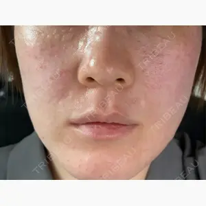 NARU SKIN Beauty Clinic口コミ