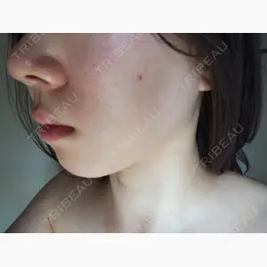 DAILY SKIN CLINIC 福岡院口コミ