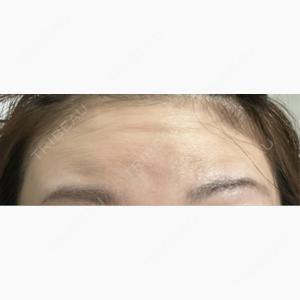 石倉クリニック 水戸院口コミ