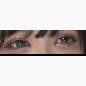 NARU Beauty Clinic 【ナルクリ】口コミ