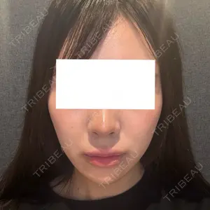 札幌美容外科ネビュラクリニック口コミ