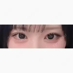 HAAB×DREAM BEAUTY CLINIC 東京本院口コミ