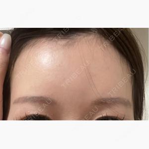 YOU&I皮膚科 明洞店口コミ