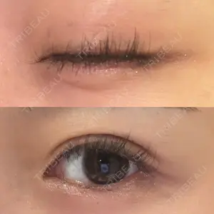 ルラ美容クリニック 郡山院口コミ