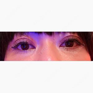 ルラ美容クリニック 札幌本院口コミ