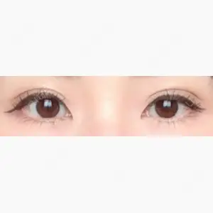 共立美容外科 高松院口コミ