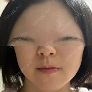 HAAB CLINIC 池袋院口コミ