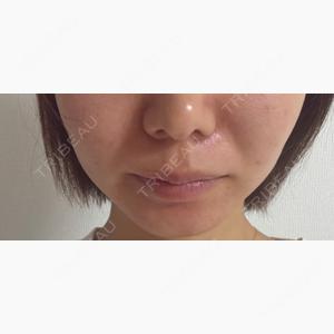 ルラ美容クリニック 札幌本院口コミ