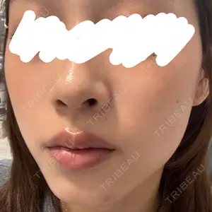 CHARIS BEAUTY CLINIC口コミ