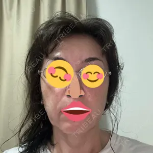 グナル美容外科梅田院口コミ